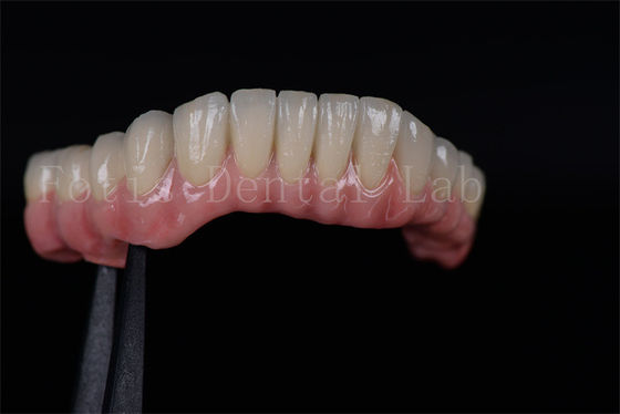 kupować Wysoki wskaźnik sukcesu Wszystkie na cztery Wszystkie na sześć Zirkonia Tytanowe implanty dentystyczne online manufacture