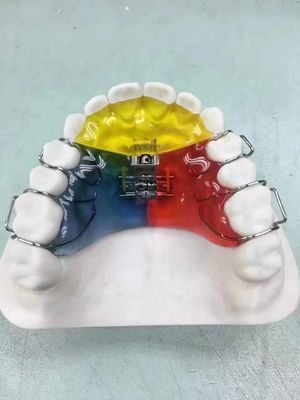 Nance / Hyrax / Rapid Palatal Expander Night Guard Space Keeper OEM Bezpieczny w użyciu
