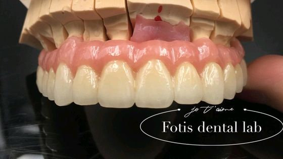Niezawodne odnowienie PFM Korony zębowe Porcelana stopiona do korony metalowej