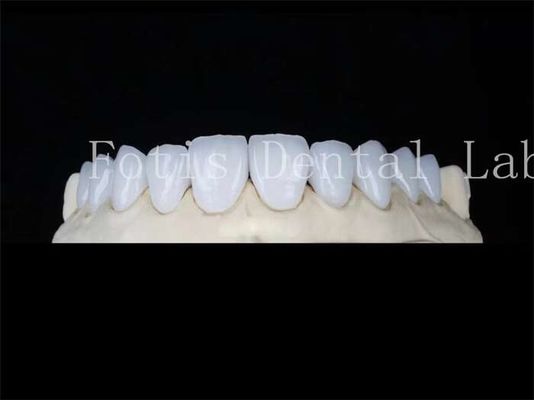 Niestandardowe naturalne podszewki z porcelany
