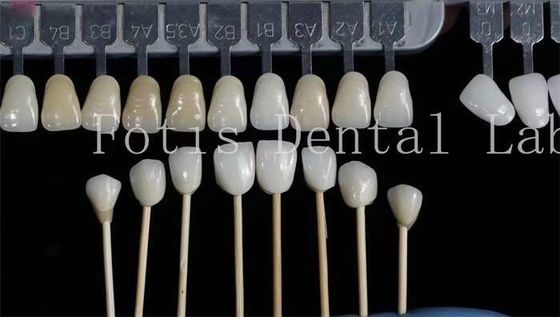 Przystosowanie naturalne finery dentystyczne fałszywe zęby pokrycia wysoka wytrzymałość