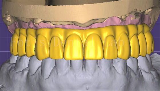 Profesjonalny projekt 3shaped Crown Doskonała wydajność i trwałość