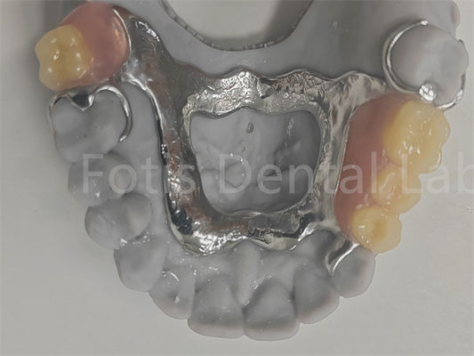 FDA Łatwe w czyszczeniu, wyjmowalne, częściowe protezy zgodne z naturalnymi zębami