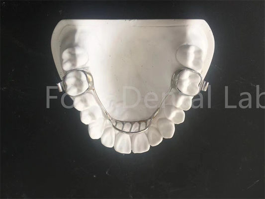Dostosowalny rozszerzający się przyczepnik Palatal Expander Retainer Łatwa konserwacja