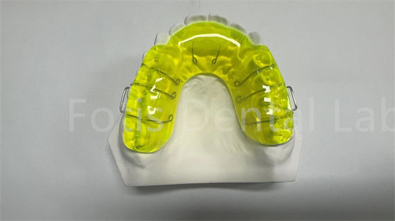 Bezpieczny Miechigan Retainer Expander / Orthodontic Spacer Appliance wygodny