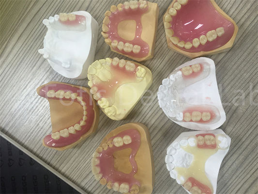Elastyczny TCS Valplast Wyjmowana częściowa proteza łatwo do regulowania