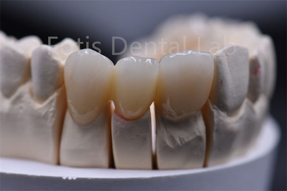 Zastosowalna grubość wielowarstwowy materiał dentystyczny z ceramiki cyrkonii