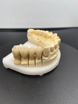Dobry wydajność Dental Zirconia Wielowarstwowe Najlepsze rozwiązanie ceramiczne