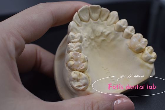 Zastosowalny nowoczesny dentystyczny inlay i onlay wszechstronne zastosowania